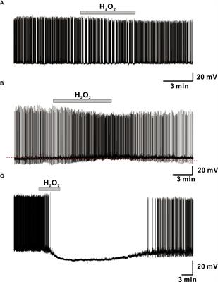 Hydrogen peroxide suppresses excitability of gonadotropin-releasing hormone neurons in adult mouse